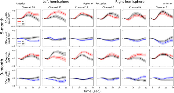 Time course of oxy‐Hb and deoxy‐Hb for heavy–light (HL) and light–heavy (LH) words in 5‐ and 9‐month‐old Japanese infants. Lightly shaded areas above and below the traces represent the standard error. Marks at 0 indicate the beginning of the stimulus presentation.