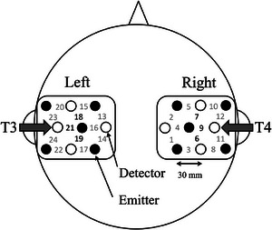 Placement of the near‐infrared spectroscopy probes. Black and white circles represent the emitter and detector, respectively. Measurement channels are numbered. The mid‐bottom detector probes for the left and right sides were placed near the T3 and T4 positions, respectively. The distance between the emitter and detector probes was 3 cm. Channels 6, 7, 9, 18, 19, and 21 are defined as regions of interest.