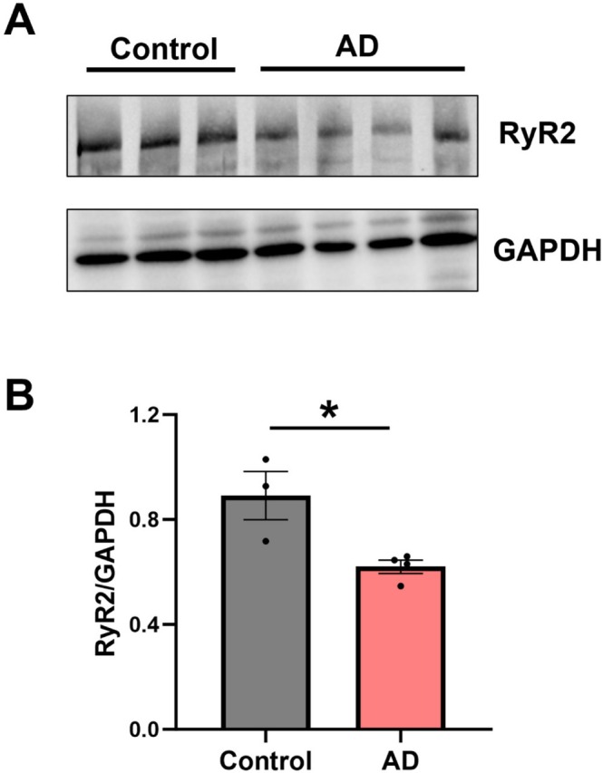 RyR2 expression is reduced in the AD mouse hippocampus. (A) Representative western blots showing total RyR2 and GAPDH expression in hippocampal tissue from control and AD mouse brains. (B) Densitometry analysis of RyR2 expression normalized to GAPDH reveals reduced expression in AD hippocampi. Data displayed shown as mean ± SEM;N= 3 control, 4 AD animals. Data analyzed using Student's unpairedt‐test; *p= 0.022. Samples run as technical triplicates.