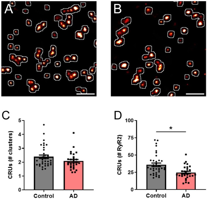 RyR2 clusters and channels are lost from CRUs in AD. Rendered dSTORM image of RyR2 labelling demonstrating the identification of CRU formation (white outlines) in hippocampal CA1 neurons from (A) control and (B) AD mice. Scale bar: 0.5 μm. Image analysis reveals the characteristics of somatic neuronal CRUs, including the mean (C) number of individual RyR2 clusters contained within a CRU, and (D) calculated number of RyR2 channels per CRU in control and AD mice. Data displayed as mean ± SEM;n= 36 (control), 28 (AD) cells fromN= 5 (control), 5 (AD) animals. Data analyzed using a Linear Mixed Effects model. Clusters/CRU:p= 0.34; RyR2/CRU: *p= 0.05.