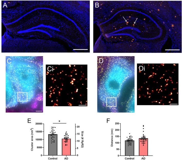 Neuronal RyR2 clusters are altered in a mouse model of AD. DAPI staining (blue) and amyloid‐β plaque deposition (Congo red staining; arrows) in the hippocampus of 9‐month‐old (A) control and (B) AD mice. Scale bar: 500 μm. Widefield NeuN (cyan) and MAP2 (magenta) labelling overlaid with super‐resolved RyR2 clusters (yellow) in the hippocampal CA1 region of (C) control and (D) AD mice. Scale bar: 2 μm. Magnified view of the region of interest (ROI; white box) in panels C and D, visualizing RyR2 clusters in (Ci) control and (Di) AD mice. Scale bar: 0.5 μm. Analysis of (E) RyR2 cluster size and (F) inter‐cluster distance (nearest neighbor, NND) in control and AD mice. Data displayed as mean ± SEM;n= 36 (control), 28 (AD) cells per group collected,N= 5 (control), 5 (AD) animals. Data analyzed using a Linear Mixed Effects model. RyR2 cluster size: *p= 0.01; inter‐cluster distance:p= 0.32.
