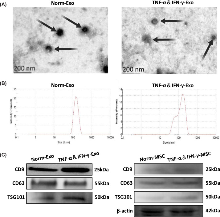 Characterization of HUCMSC-Exo(A) TEM analysis of Norm-Exo and TNF-α&IFN-γ-Exo (scale bar = 200 nm). (B) NTA of Norm-Exo and TNF-α&IFN-γ-Exo. (C) WB confirmed that Norm-Exo and TNF-α&IFN-γ-Exo express marker proteins CD9, CD63, and TSG101 (n= 3), full-length uncropped blots are shown in Supplementary Figure S7.
