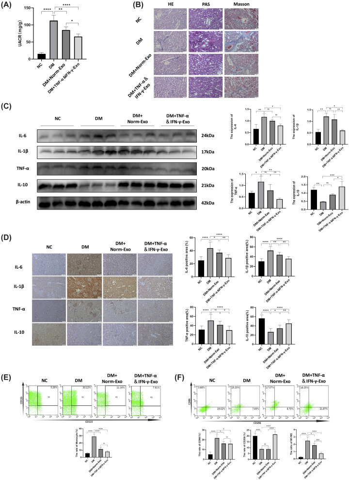 HUCMSC-Exo ameliorated inflammation of renal and regulated macrophage polarization in T1DM mice(A) The change of UACR. (B) HE, PAS, and MTS on renal tissue. Scale Bar = 50 μm. (C) WB and quantification results of IL-6, IL-1β, TNF-α, and IL-10 in kidney tissue of mice. (D) The expression levels of pro-inflammatory cytokines IL-6, IL-1β, TNF-α, and anti-inflammatory cytokines IL-10 in renal tissues were detected by Immunohistochemical staining and their positive area was evaluated by ImageJ. Scale Bar = 50 μm. (E) Changes in the proportion of monocytes (Ly6G−, CD3−, B220−, and CD11b+, CD115+) in the spleen was determined by Flow cytometry. (F) Changes in the proportion of macrophage (CD11b+and F4/80+) and its subtypes (M1(CD86+) and M2(CD206+)) in the renal was determined by Flow cytometry. (n= 5), statistical differences among groups were analyzed using one-way ANOVA followed by Tukey’s post hoc test, ns indicates no significant difference,P> 0.05, *P< 0.05, **P< 0.01, ***P< 0.001, ****P< 0.0001. Full-length uncropped blots are shown in Supplementary Figure S8. Data are presented relative to the non-diabetic control (NC) group, which serves as the physiological baseline.