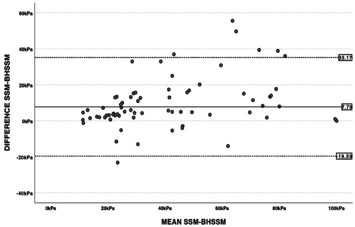 Bland–Altman plot of differences between spleen stiffness measurements during a normal respiratory cycle (SSM) and during a breath hold (BH‐SSM) and the mean of the two. The black line indicates the mean difference between the two methods, while the dashed lines delimit the 95% confidence interval of the differences.