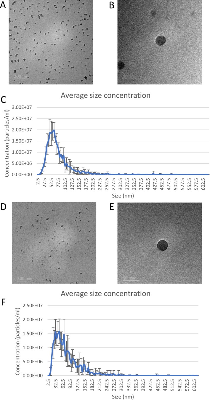 Particle characterisation of PS NPs. (A, B) TEM images at 20 000× and 100 000× magnification, and (C) size distribution histogram of 20 nm PS NPs; (D, E) TEM images at 15 000× and 100 000× magnification and (F) size distribution histogram of 30 nm PS NPs.