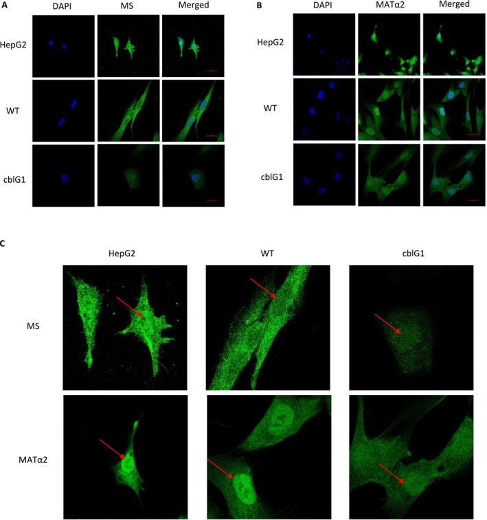 Confirmation of nuclear location of methionine synthase (MS) and MATα2 in HepG2 cells, control and cblG patient fibroblasts. (A, B) Immunofluorescence staining of MS and MATα2 in HepG2 cells, control (WT), and cblG fibroblasts. Cells were stained with anti‐MS (A) and anti‐MATα2 (B) antibodies and visualized by confocal microscopy (N= 3). Adjustments of individual colour channels were performed with Photoshop. (C) Zoom of MS and MATα2 staining presented in FigureS2A,B.