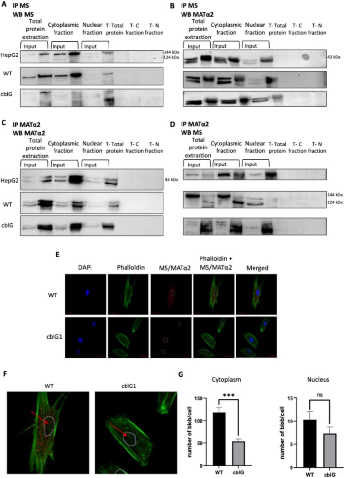 Evidence of protein–protein interaction between methionine synthase and methionine adenosyltransferase 2A (MATα2) in total protein extracts, cytoplasmic and nuclear fractions of HepG2 cells, control and cblG fibroblasts. (A) Validation of methionine synthase (MS) immunoprecipitation. Co‐immunoprecipitation assay was performed on total protein extract, cytoplasmic and nuclear fractions of HepG2 cells, control (WT), and cblG fibroblast cells with an antibody against MS. Immunoprecipitated samples were subjected to western blot against MS with another antibody (N= 4). C, cytoplasm; N, nucleus; T, control without antibody which realized immunoprecipitation. (B) Evidence of interaction between MS and MATα2 subunit. Co‐immunoprecipitation assay was performed on total protein extract, cytoplasmic and nuclear fractions of HepG2 cells, control (WT), and cblG fibroblast cells with an antibody against MS. Immunoprecipitated samples were subjected to western blot against MATα2 (N= 4). C, cytoplasm; N, nucleus; T, control without antibody which realized immunoprecipitation. (C) Validation of immunoprecipitation of MATα2. Co‐immunoprecipitation assay was performed on total protein extract, cytoplasmic and nuclear fractions of HepG2 cells, control (WT), and cblG fibroblasts cells with an antibody against MATα2. Immunoprecipitated samples were subjected to western blot against MATα2 with another antibody (N= 3). C, cytoplasm; N, nucleus; T, control without antibody which realized immunoprecipitation. (D) Validation of interaction between MS and MATα2. Co‐immunoprecipitation assay was performed on total protein extract, cytoplasmic and nuclear fractions of HepG2 cells, control (WT), and cblG fibroblasts cells with an antibody against MATα2. Immunoprecipitated samples were subjected to western blot against MS (N= 3). C, cytoplasm; N, nucleus; T, control without antibody which realized immunoprecipitation. (E) Confirmation of interaction between MS and MATα2. Duolink Proximity Ligation Assay was performed on control (WT), and cblG fibroblasts. Red blobs indicate protein–protein interactions between MS and MATα2 (N= 3). Adjustments of individual colour channels were performed with Photoshop. (F) Zoom of MS and MATα2 interaction staining presented in FigureS5E. (G) Quantification of the number of blobs in the cytoplasm and in the nuclei of WT and cblG fibroblasts; mean ± SEM,n= 3; ***p< 0,001; Two‐way ANOVA; GraphPad.