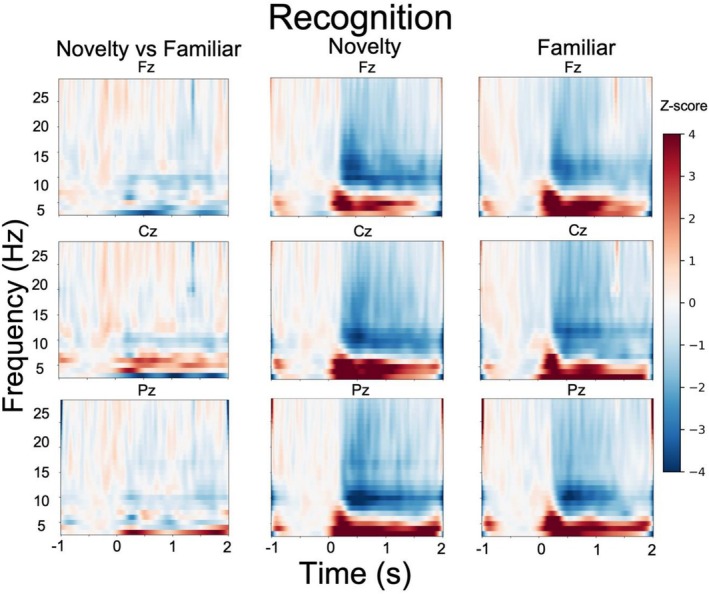 Novel versus familiar successful encoding of subsequent recognition.