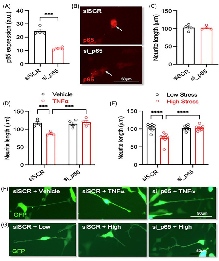 Knockdown of p65 prevents the detrimental effects of exposure to serum with a ‘high-stress’ biological signature on neurite growth(A) Graph of p65 expression, (B) representative photomicrographs of p65 staining (red), and (C) graph of neurite length in RA-differentiated SH-SY5Y cells transfected with 10 nM of a scrambled siRNA or an siRNA against the NF-kB subunit p65 (si_p65) and analysed at 72 h post-transfection. (D) Graph of neurite length and (F) representative photomicrographs of SH-SY5Y cells transfected with 10 nM of siSCR or si_p65 and cultured with or without 20 ng/mL TNFα for 72 h.N= 4 independent experiments. (E) Graph of neurite length and (G) representative photomicrographs of SH-SY5Y cells transfected with 10 nM of siSCR or si_p65 and cultured in the presence of 3% (v/v) serum with a ‘low-stress’ (N= 10) and ‘high-stress’ (N= 10) biological signature for 72 h. Scale bar = 50 μm. Data are presented as mean ± SEM and analysed using (A, C) a Student’s unpairedt-test or (D, E) a two-way ANOVA with post-hoc Fishers LSD test (***P<0.001; ****P<0.0001; n.s. = not significant).