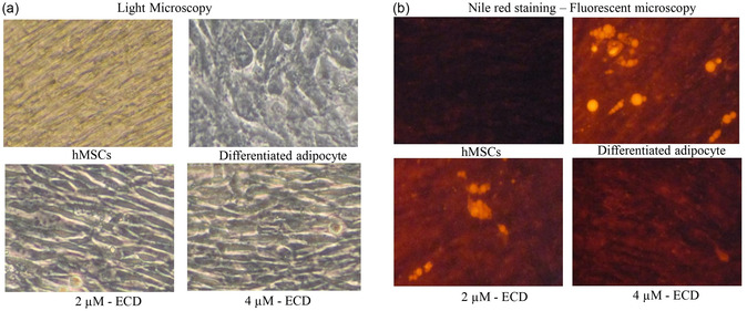 Assessment of lipid accumulation by Nile red staining. Determination, differentiation, and intracellular lipid levels using Nile red staining in ECD‐treated preadipocytes after 14 days. Adipocytes were treated with ECD at 2 µM and 4 µM concentrations. (a) Light microscopy images, (b) Fluorescent microscopy images.