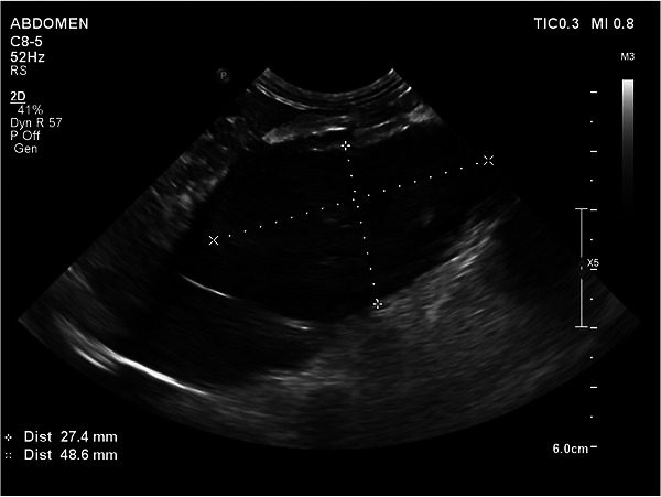 Abdominal ultrasonography after 2 months of therapy. The cranial abdominal mass measured approximately 4.9 × 2.7 cm, markedly reduced compared with the initial study, indicating partial therapeutic response.