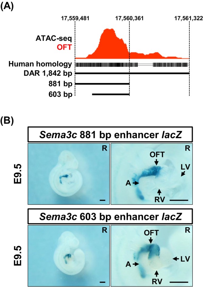 A 603 bp minimal enhancer exhibits OFT‐specific activity. (A) Two truncated enhancer fragments (881 and 603 bp) are derived from the OFT‐specific DAR based on chromatin accessibility profiles. (B) Both minimal enhancer fragments drove OFT‐specific reporter activity in F0 transient transgenic embryos. The spatial pattern of reporter activity driven by the 881 bp (n= 2/2) and 603 bp (n= 5/8) fragments is shown. A, atrium; LV, left ventricle; OFT, outflow tract; R, right view; RV, right ventricle. Scale bar: 500 μm.