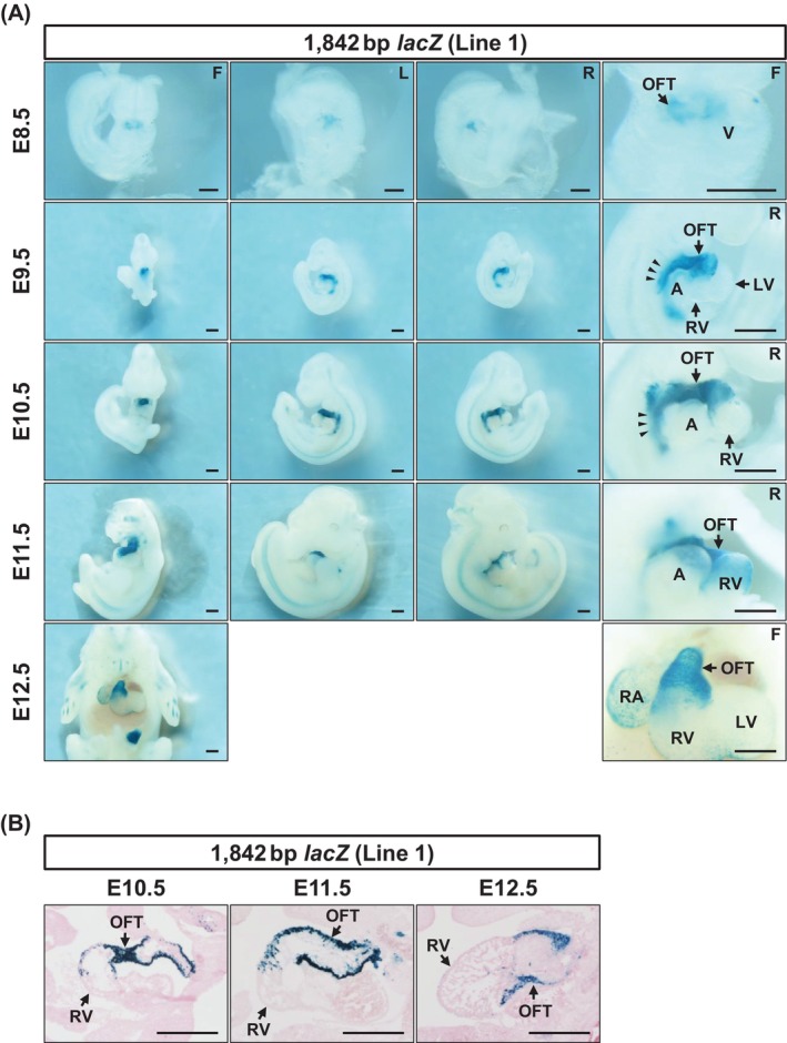 The 1842 bp enhancer exhibits temporally sustained and OFT‐specific transcriptional activity during heart development. (A) Representative images of whole‐mount X‐gal staining of 1842 bp enhancer‐hsp68‐lacZtransgenic embryos are shown. At E8.5, reporter activity was detected in the early OFT of the developing heart tube. During the looping stages (E9.5–E11.5), enhancer activity was observed in the OFT but not in the RV. Reporter activity was also detected in a domain corresponding to the SHF at E9.5 and E10.5 (arrowheads). At the four‐chamber stage (E12.5), enhancer activity remained localized to the OFT. Although weak reporter activity was observed in the right atrium in a subset of embryos, analysis of additional independent transgenic lines confirmed that enhancer activity was not reproducibly detected in the right atrium. The E9.5 image is the same as shown in Figure2A. X‐gal staining was performed at 37°C°C for 2 h (E9.5) or 24 h (E8.5 and E10.5–E12.5). (B) Cryosections prepared at E10.5–E11.5 exhibited that reporter activity was localized to the myocardial layer of the OFT. A, atrium; F, front view; L, left view; LV, left ventricle; OFT, outflow tract; R, right view; RA, right atrium; RV, right ventricle; V, ventricle. Scale bar: 500 μm.