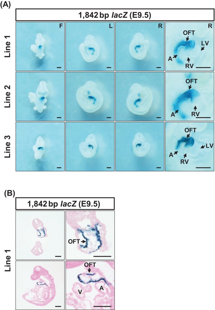 The 1842 bp enhancer candidate exhibits OFT‐specific transcriptional activity in the E9.5 mouse myocardium. (A) Three independent lines of 1842 bp enhancer‐hsp68‐lacZtransgenic reporter mouse were analyzed. Representative images of whole mount X‐gal staining (37°C°C for 2 h) are shown. (B) To further assess the cellular localization of reporter activity observed in OFT, cryosections were prepared.LacZactivity driven by the 1842 bp DAR was localized to the myocardial layer of the OFT. A, atrium; F, front view; L, left view; LV, left ventricle; OFT, outflow tract; R, right view; RV, right ventricle. Scale bar: 500 μm.