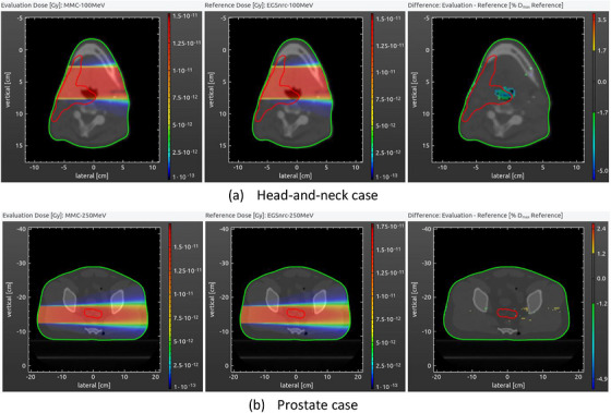 Dose distributions in an axial slice calculated with monoenergetic 5 × 5 cm2parallel electron beams using MMC (left) and EGSnrc (middle), with the corresponding dose difference map shown on the right. (a) Head‐and‐neck case with a 100 MeV beam. (b) Prostate case with a 250 MeV beam. The planning target volume (PTV) and the body are contoured with red and green lines, respectively.