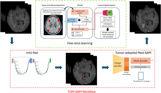 Overview of the proposed TUM‐SAM framework and tumor‐adapted Med‐SAM training strategy. Bottom (red dashed box): Inference workflow. nnU‐Net first performs fully automated brain metastasis detection on post‐contrast T1‐weighted MRI and generates coarse tumor masks. These detections are converted into per‐lesion bounding‐box prompts, which are passed to the tumor‐adapted Med‐SAM to refine each lesion and produce the final segmentation. Top (green dashed box): Tumor‐adapted Med‐SAM training architecture. Each metastasis is processed independently using its own bounding‐box prompt, enabling multi‐instance learning within a single image. The Image Encoder (ViT‐B) and Mask Decoder are fine‐tuned, while the Prompt Encoder remains frozen. Per‐lesion DSC and binary cross‐entropy (BCE) losses are aggregated via gradient accumulation to support efficient few‐shot training.