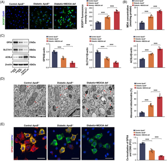 Mex‐3 RNA‐binding family member A (MEX3A) deficiency enhances ferroptosis‐associated injury in macrophages within diabetic atherosclerotic plaques. (A) BODIPY‐C11/4′,6‐diamidino‐2‐phenylindole (DAPI) fluorescence images and quantification of BODIPY‐C11 fluorescence intensity in aortic root plaques. Scale bars, 50 µm. (B) Aortic malondialdehyde (MDA) concentration. (C) Western blot analysis and quantification of GPX4, SLC7A11 and ACSL4 normalised to beta‐actin. (D) Transmission electron microscopy (TEM) images showing mitochondrial morphology and quantification of abnormal mitochondria. Red arrows indicate abnormal mitochondria. Scale bars, 500 nm. (E) Immunofluorescence images showing GPX4 (red), CD68 (green) and DAPI (blue) and quantification of GPX4/CD68 co‐localisation by Pearson correlation coefficient (PCC). Scale bars, 20 µm.n= 6 mice per group. Data are mean ± standard deviation (SD). One‐way analysis of variance (ANOVA) with Tukey's post hoc test.***p< .001.