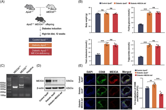 Generation of the diabetic atherosclerosis model with Mex‐3 RNA‐binding family member A (MEX3A) deficiency and baseline characterisation. (A) Schematic of the in vivo experimental design.ApoE−/−mice were crossed withMex3a+/−mice to generateApoE−/−Mex3a+/−offspring. Diabetes was induced with streptozotocin (STZ), followed by high‐fat diet (HFD) feeding for 12 weeks. (B) Body weight, fasting glucose, total cholesterol and triglycerides in controlApoE−/−, diabeticApoE−/−and diabetic + MEX3A def mice.n= 6 mice per group. (C) PCR genotyping ofMex3aalleles. (D) Western blot analysis of MEX3A protein in aortic tissues; beta‐actin was used as loading control. (E) Representative immunofluorescence images showing 4′,6‐diamidino‐2‐phenylindole (DAPI) (blue), CD68 (green), MEX3A (red) and merged signal in aortic root plaques. Right, quantification of CD68/MEX3A co‐localisation by Pearson correlation coefficient (PCC). Scale bars, 200 µm. Data are mean ± standard deviation (SD). One‐way analysis of variance (ANOVA) with Tukey's post hoc test. ns, not significant;**p< .01;***p< .001.