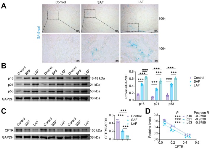 Increased senescence markers and reduced CFTR expression in LAA of AF patients. (A) SA‐β‐gal staining. (B) WB analysis of p16, p21 and p53. (C) WB analysis of CFTR. (D) Pearson correlation analysis was performed to examine the correlations of CFTR with p16, p21, and p53 separately.n= 6, ***p< 0.001.