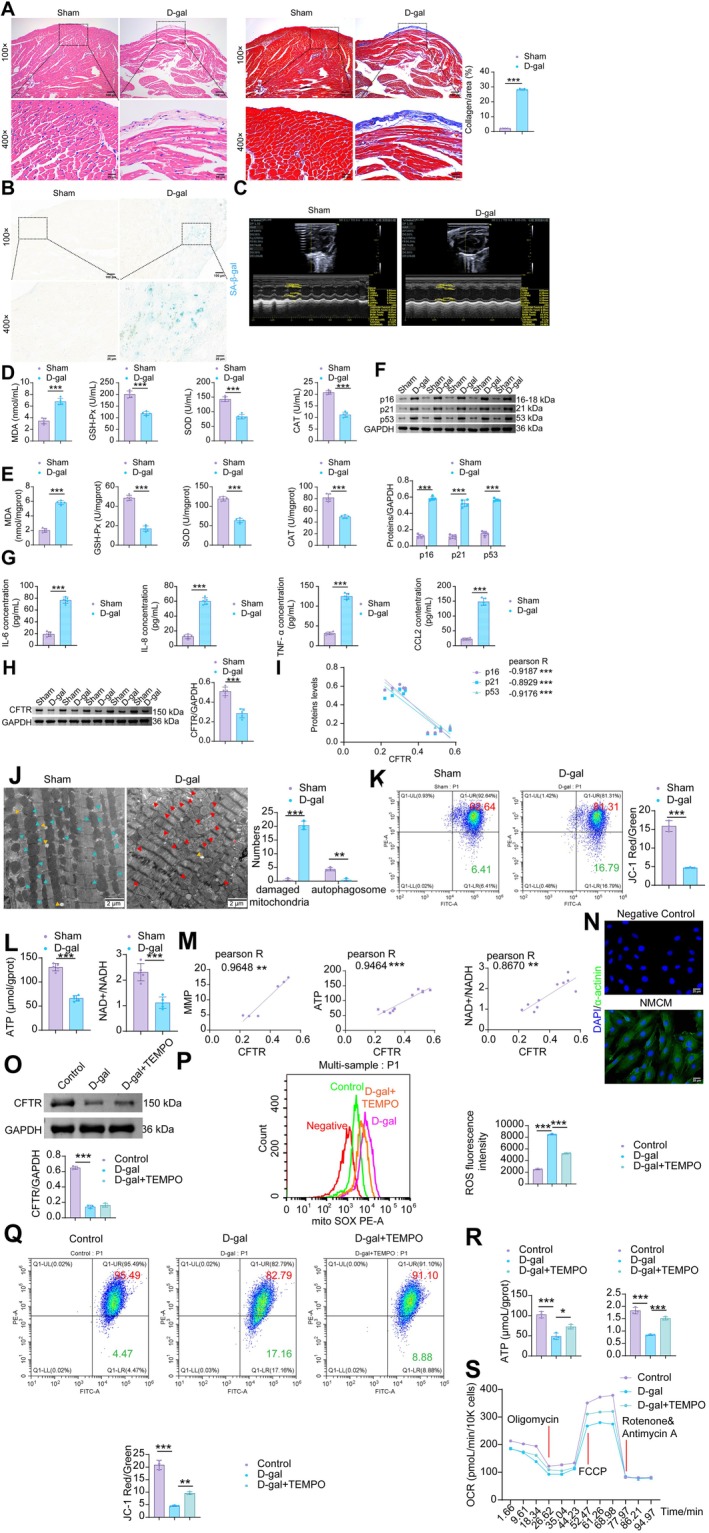 The decrease in CFTR in cardiac myocytes coincides with elevated mitochondrial oxidative stress in the aging murine heart. (A) H&E and Masson staining of mouse myocardial tissue. (B) SA‐β‐gal staining in mouse myocardial tissue. (C) Echocardiography examination. (D) The levels of MDA, SOD, GSH‐Px and CAT in the peripheral blood of mice. (E) The levels of MDA, SOD, GSH‐Px and CAT in the mouse myocardial tissue. (F) The protein levels of p16, p21 and p53 in the mouse myocardial tissue. (G) The levels of SASP factors (IL‐6, IL‐8, TNF‐α, and CCL2) in the mouse myocardial tissue. (H) The protein levels of CFTR in the mouse myocardial tissue. (I) Pearson Correlation Analysis of CFTR with p53, p21, and p16 Expression. (J) Assessment of mitochondrial damage in mouse CMs by TEM. (K) Flow cytometric JC‐1 staining for the determination of MMP in mouse myocardial tissue. (L) ATP and NAD+/NADH levels in mouse myocardial tissue. (M) Pearson correlation analysis of CFTR with ATP and NAD+/NADH levels in mouse myocardial tissue. (O) IF staining of α‐actinin for extracting NMCMs. (N) WB analysis of CFTR in NMCMs. (P) Flow cytometric analysis of mitochondrial ROS in NMCMs. (Q) Flow cytometric JC‐1 staining for the determination of MMP in NMCMs. (R) ATP and NAD+/NADH levels in NMCMs. (S) Mitochondrial oxygen consumption rate (OCR) levels in NMCMs were measured using an XFe96 Flux Analyzer. Data are presented as mean ± SD. The sample sizes weren= 5 for Figure2A–Mandn= 3 for Figure2N–S. *p< 0.05, **p< 0.01, ***p< 0.001.