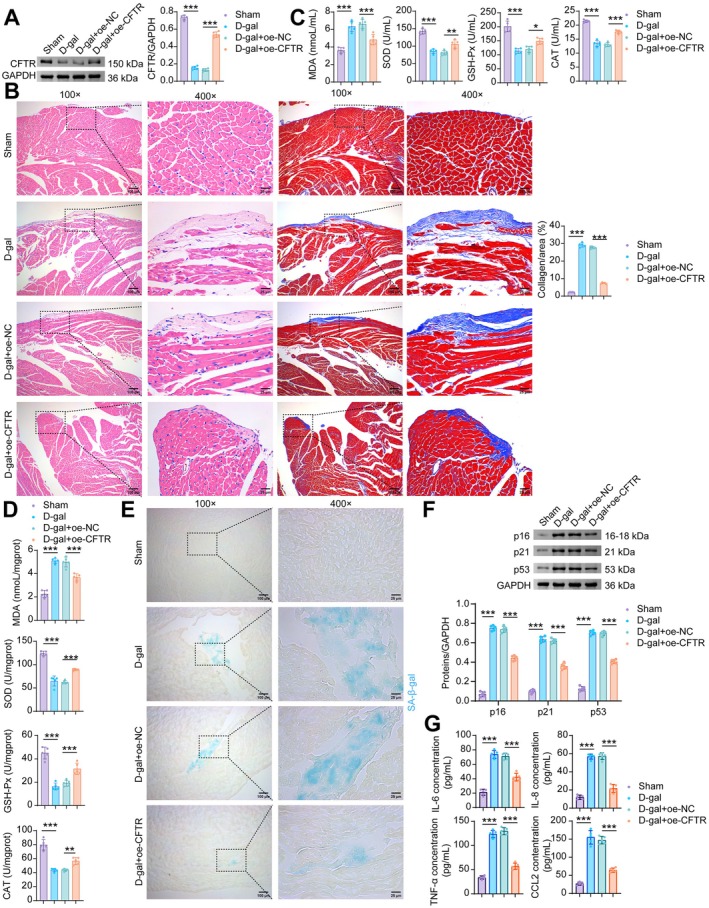 Overexpression of CFTR rescues mice from D‐galactose‐induced cardiac senescence. (A) WB analysis of CFTR. (B) H&E and masson staining. (C) The levels of MDA, SOD, GSH‐Px and CAT in the serum of mice. (D) The levels of MDA, SOD, GSH‐Px and CAT in the mouse myocardial tissue. (E) SA‐β‐gal staining of the mouse myocardial tissue. (F) The levels of p16, p21, and p53 proteins in the mouse myocardial tissue. (G) The levels of SASP factors (IL‐6, IL‐8, TNF‐α, and CCL2) in the mouse myocardial tissue. Data are presented as mean ± SD,n= 5, *p< 0.05, **p< 0.01, ***p< 0.001.