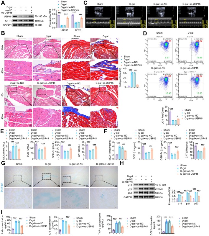 USP45 rescues cardiac aging and mitochondrial damage by mediating CFTR stabilization. (A) WB analysisi of USP45 and CFTR in the mouse myocardial tissue. (B) H&E and Masson staining of mouse myocardial tissue. (C) Echocardiography examination. (D) Flow cytometric JC‐1 staining for the determination of MMP in mouse myocardial tissue. (E) The levels of MDA, SOD, GSH‐Px and CAT in the serum of mice. (F) The levels of MDA, SOD, GSH‐Px and CAT in the mouse myocardial tissue. (G) SA‐β‐gal staining in mouse myocardial tissue. (H) The protein levels of p16, p21 and p53 in the mouse myocardial tissue. (I) The levels of SASP factors (IL‐6, IL‐8, TNF‐α, and CCL2) in the mouse myocardial tissue. Data are presented as mean ± SD,n= 5, *p< 0.05, ***p< 0.001.