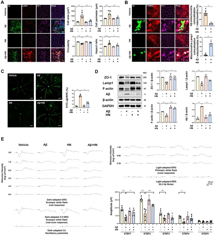 HN alleviates Aβ‐induced degenerative changes in the RPE and the retina. (A) Representative images of the RPE subretinally injected with FITC‐labeled Aβ demonstrate that HN restores the Aβ‐induced degenerative changes, characterized by increased cell size and irregularity. Morphological changes were quantified with cell size, perimeter, circularity, and aspect ratio. Scale bar, 10 μm.n= 6 mice. (B) Representative images of the RPE subretinally injected with FITC‐labeled Aβ, stained with TOM20 (red) and ZO‐1 (magenta), with quantification focusing on mitochondria in RCSs. Scale bar, 10 μm.n= 6 mice. (C) Localization and quantification of subretinally injected FITC‐labeled Aβ in flat‐mounted RCSs. HN reduces the distribution area of Aβ in the entire RCSs. Scale bar, 500 μm.n= 5 mice. (D) Representative immunoblot and densitometry graphs of the RPE and choroid lysate demonstrate promoted Aβ clearance and alleviation of tight junction disruption. Three biologically independent experiments were performed. (E) Representative scotopic and photopic full‐field ERG waveforms illustrating Aβ‐induced amplitude decrease, partially rescued by HN.n= 5 mice. Data are presented as mean ± SD.pvalues were determined using one‐way ANOVA with Tukey's multiple‐comparison analysis (A, D, E, F) and unpaired two‐tailed Student'st‐test (B, C). *p< 0.05, **p< 0.01, and ***p< 0.001.