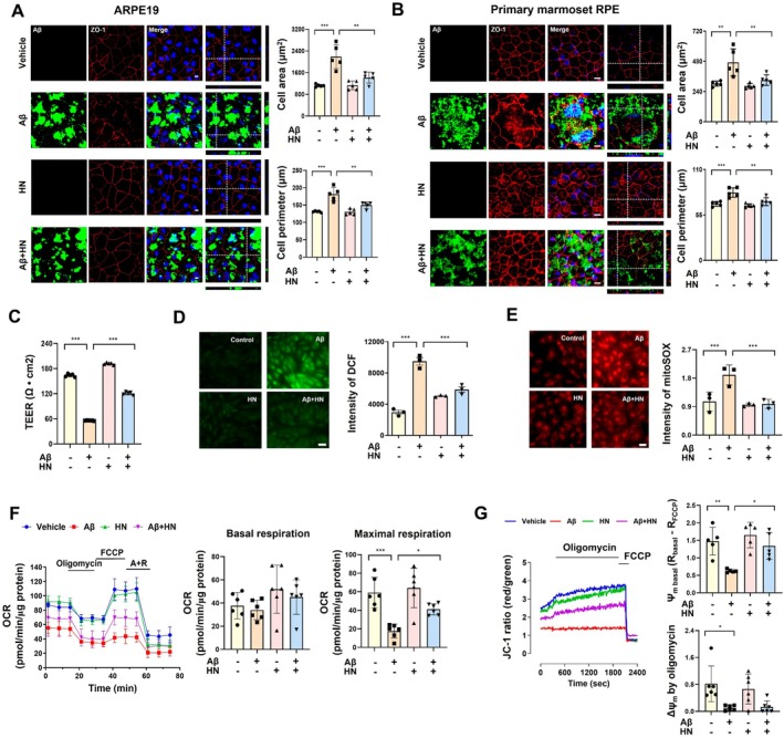 HN mitigated Aβ‐induced oxidative stress, mitochondrial dysfunction, and degenerative changes in RPE cells. (A) Representative confocal images depict disrupted ARPE19 cell morphology, characterized by increased cell size and perimeter due to the entry of FITC‐labeled Aβ. HN treatment restores the morphology to a state similar to that of vehicle‐treated cells. Images and quantification were obtained 24 h after exposure to Aβ and HN. Scale bar, 10 μm. (B) Representative images depict primary marmoset RPE cell morphology similar to ARPE19 cells. Images and quantification were obtained 24 h after exposure to Aβ and HN. Scale bar, 10 μm. (C) Primary marmoset RPE cells differentiated on transwell membranes were exposed to Aβ and HN, and TEER was measured 24 h later. TEER demonstrates that HN preserves tight junction integrity and barrier function, which had been disrupted by Aβ. (D and E) ARPE19 cells were loaded with DCF‐DA (5 μM) or mitoSOX (5 μM) to measure cytosolic (D) or mitochondrial (E) ROS generation, respectively, through fluorescence imaging analysis. (F), The oxygen consumption rate (OCR) was measured in ARPE19 cells using an XF‐96 analyzer, recording baseline level and the effects of oligomycin, FCCP, and antimycin A/rotenone (A +R). (G) ARPE19 cells were loaded with JC‐1 (350 nM) and measure the red (Ex/Em: 490/535 nm) and green (540/590 nm) using FlexStation. Mitochondrial membrane potential (ΔΨm) was estimated using the JC‐1‐induced fluorescence ratio of red to green. The number of biologically independent experiments is 5 in (A, B, F, G), 4 in (C), and 3 in (D, E). Data are presented as mean ± SD.pvalues were determined using one‐way ANOVA with Tukey's multiple‐comparison analysis. *p< 0.05, **p< 0.01, and ***p< 0.001. Scale bar, 20 μm.