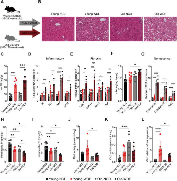 Intrahepatic thyroid hormone (TH) concentrations declined with aging and MASLD progression, with reduced Dio1 and increased Dio3 activities. (A) Schematic showing administration protocol for Western Diet with 15% fructose in the drinking water (WDF) for 8 weeks compared to Normal Chow Diet (NCD) in the young and old mice (n= 7–8 per group). (B) Representative liver histological images (10 × scale bar = 100 μm). (C) Liver triglyceride (TG) content. (D, E) Hepatic mRNA expression of inflammatory and fibrotic markers. (F) Hepatic hydroxyproline (HPA) content. (G) Senescence‐related mRNA expression. (H, I) Intrahepatic T4 and T3 concentrations. (J, K) Dio1 and Dio3 activity. (L)Dio1relative mRNA expression. Statistical analysis was performed by two‐way ANOVA with subsequent Tukey's multiple comparison. Data were presented as mean ± SD. *p< 0.05, **p< 0.01, ***p< 0.001, ****p< 0.0001.