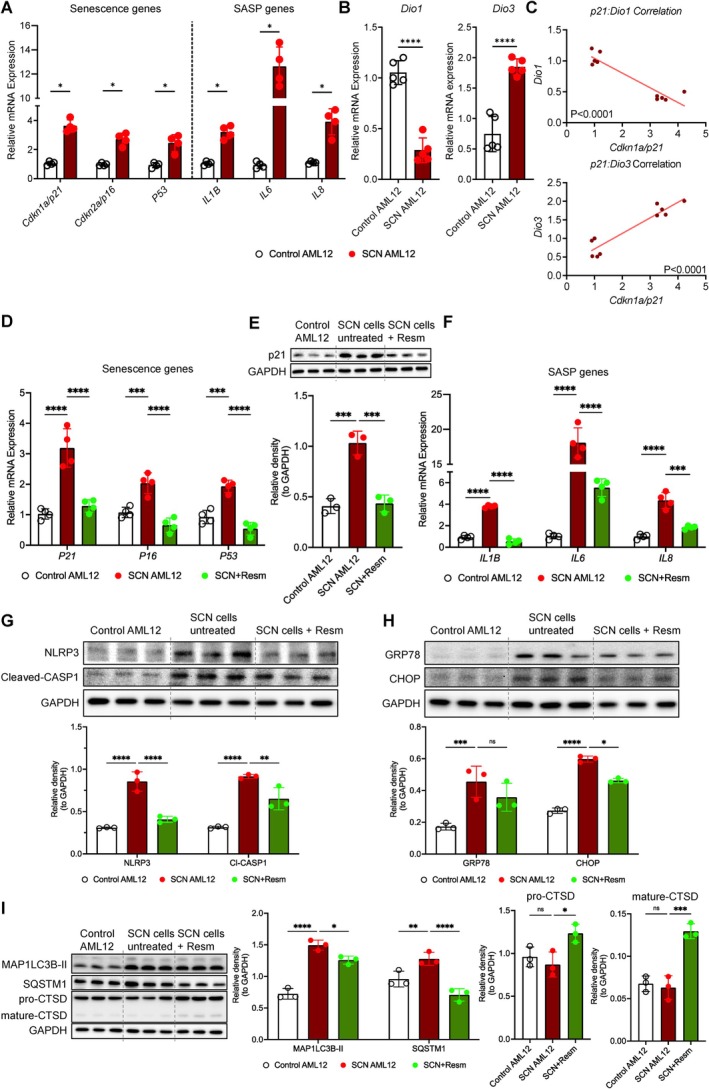 Dio1 expression was reduced in hepatocellular senescence and resmetirom improved senescence‐associated stress and inflammatory phenotype. (A) Hepatic mRNA expression of senescence (SCN) and senescence‐associated secretory phenotype (SASP) genes. (B)Dio1andDio3mRNA expression. (C) Linear regression and correlation analysis for SCN genep21(SCN marker) withDio1andDio3mRNA expression. (D)p21,p16, andp53mRNA expression, and (E) p21 protein levels (Western blot, with quantification). (F) Resmetirom effects onIL‐1β,IL‐6, andIL‐8mRNA expression. (G) NLRP3 and cleaved caspase‐1 (CASP1) protein levels (Western blot, with quantification). (H) BiP/GRP78 and CHOP protein levels (Western blot, with quantification). (I) Autophagy markers: MAP1LC3B‐II, p62/SQSTM1, pro‐CTSD, and mature CTSD protein levels (Western blot, with quantification). All data are representative of ≥ 3 independent experiments. Statistical testing was performed using unpaired Student'st‐test or one‐way ANOVA with subsequent Tukey's multiple comparison. Data were presented as mean ± SD. ns = no significance, *p< 0.05, **p< 0.01, ***p< 0.001, ****p< 0.0001.