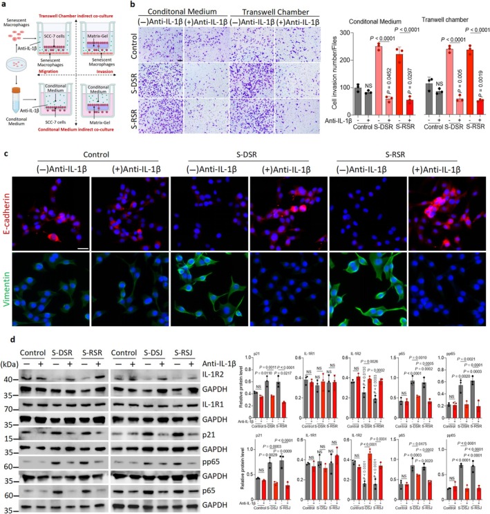 Exogenous recombinant IL‐1β promotes oral cancer invasion and blocking IL‐1β attenuates this process and downstream signaling pathway. (a) Schematic of the migration and invasion transwell assays. Briefly, SCC‐7 cells in a transwell chamber were challenged to migrate through transwell with 5 μm pores. For the invasion assay, SCC‐7 cells were seeded at the bottom of the transwell chambers that had been coated with matrigel. The migration or invasion of SCC‐7 cells was induced by senescent macrophage‐derived CM or indirect co‐culture with senescent macrophages. (b) Representative images and quantification of invasion assays after treatment with an anti‐IL‐1β antibody. Scale bar, 100 μm. (c) Representative images of immunofluorescence staining of E‐cadherin and Vimentin in SCC‐7 indirectly co‐cultured with DSR or RSR, treated with or without anti‐IL‐1β antibody. Scale bars, 100 μm. (d) SCC‐7 cells indirectly co‐cultured with senescent macrophages were treated with an anti‐IL‐1β antibody. Immunoblots of p21, IL‐1R1, IL‐1R2, p65, and pp65 levels in SCC‐7 cells.n= 3 in each group from independent biological replicates and statistical significance was determined by one‐way ANOVA with Tukey's post hoc test; mean ± s.d. (b, d).