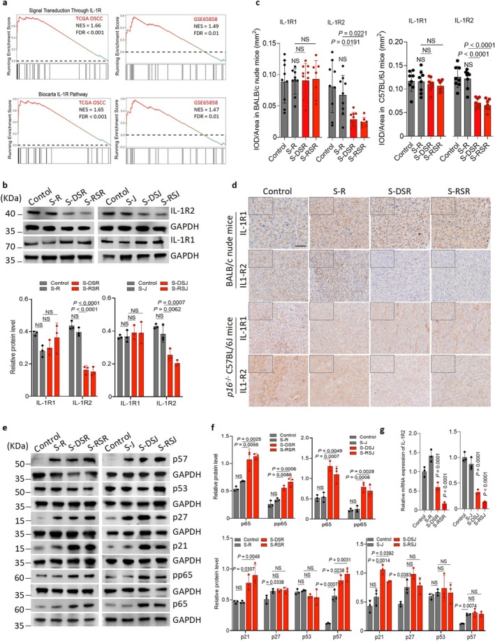 Senescent macrophage‐derived IL‐1β drives oral cancer invasion via the IL‐1β/IL‐1R/NFκB signaling cascade. (a) Gene Set Enrichment Analysis (GSEA) results of OSCC tissues from the TCGA andGSE65858datasets in Signal Transduction Through IL‐1R and Biocarta IL‐1R pathway sets. (b, c) Immunoblots and quantification of IL‐1R1 and IL‐1R2 levels in SCC‐7 cells indirectly co‐cultured with R, DSR, RSR, J774A.1 cells (J), DSJ or RSJ. (d) Representative IHC images of IL‐1R1 and IL‐1R2 staining in tumor sections from BALB/c nude mice andp16−/−C57BL/6J mice implanted with SCC‐7 cells with/without macrophages. BALB/c nude mice model: SCC‐7 cells (n= 9), S‐R (n= 9), S‐DSR (n= 10), S‐RSR (n= 7).p16−/−C57BL/6J mice model: SCC‐7 cells (n= 8), S‐R (n= 8), S‐DSR (n= 8), and S‐RSR (n= 8). Scale bar, 50 μm. (e, f). Immunoblots and quantification of p21, p27, p53, p57, p65, and pp65 levels in SCC‐7 cells indirectly co‐cultured with R, DSR, RSR, J, DSJ or RSJ. (g) Relative expression of IL‐1R2 mRNA in senescent macrophage.n= 3 in each group from independent biological replicates and statistical significance was determined by one‐way ANOVA with Tukey's post hoc test; mean ± s.d. (b, f).