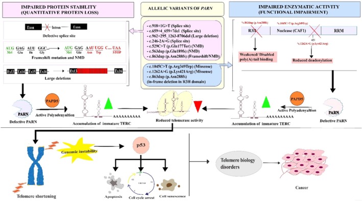 Depiction of the Interplay between PARN, telomere maintenance, and p53 signaling. The above figure illustrates how the identifiedPARNgenetic variants drive clinical pathogenesis, in telomerase deregulation, with p53 involvement contributing to a high cancer risk condition in TBD patients. The identifiedPARNvariants are displayed in the diagram along with their variation status. The quantitative loss of PARN protein due to impaired protein stability (Top left, pink) occurs as a result of defective splice sites, frame shift mutations, and nonsense‐mediated decay (NMD). Conversely, functional/enzymatic impairment despite stable protein abundance (Top right, blue) is displayed as a consequence of missense mutations or a disabled R3H domain, which is primarily involved in poly (A) tail binding. Usually, PARN promotes TERC maturation by removing PAPD5‐mediated oligoadenylation, which prevents RNA decay. The loss of functional PARN leaves PAPD5 unopposed, causing hyper‐polyadenylation resulting in accumulation of polyadenylated TERC (immature TERC shown in green cone) leading to its decay. This leads to lack of telomerase activity (shown in red cone). A reduced telomerase activity triggers genomic destabilization through shortening of telomeres at the end of the chromosomes. This recruits DNA damage signaling, phosphorylating p53, which then induces DDR that halt the cell cycle process, thereby promoting apoptosis or cell senescence. This results in severe clinical phenotypes as observed in TBD patients with skin aberrations, nail dysplasia and others. Over time, chromosomal fusions tend to progress into cancer, which decreases the patient's survival rate. This image was created using Adobe Illustrator.