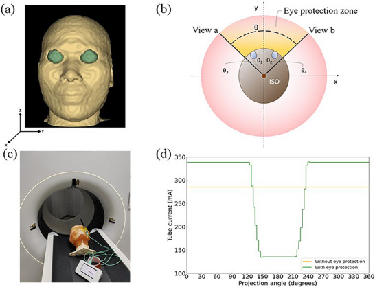 Illustration of eye protection and phantom verification. (a) The derived 3D eyeball mask generated by our EyeGen‐Net model is shown in green. (b) Schematic diagram for protection angle (θ) calculation from the scanner isocenter (ISO). The red circle represents the axial scanning plane; the brown circle represents the outer contour of the head; and the two blue circles represent the transverse cross‐sections of the left and right eyeballs. (c) Experimental setup for phantom validation. The PBU‑60 head phantom is positioned on the CT table with the RaySafe X2 dosimeter probe affixed to the eye surface for lens dose measurement. The same phantom setup was used for image quality evaluation under identical scanning conditions. (d) Representative tube current modulation curves recorded during the phantom experiment, comparing the standard (without eye protection) and OBTCM‑enabled (with eye protection) modes.