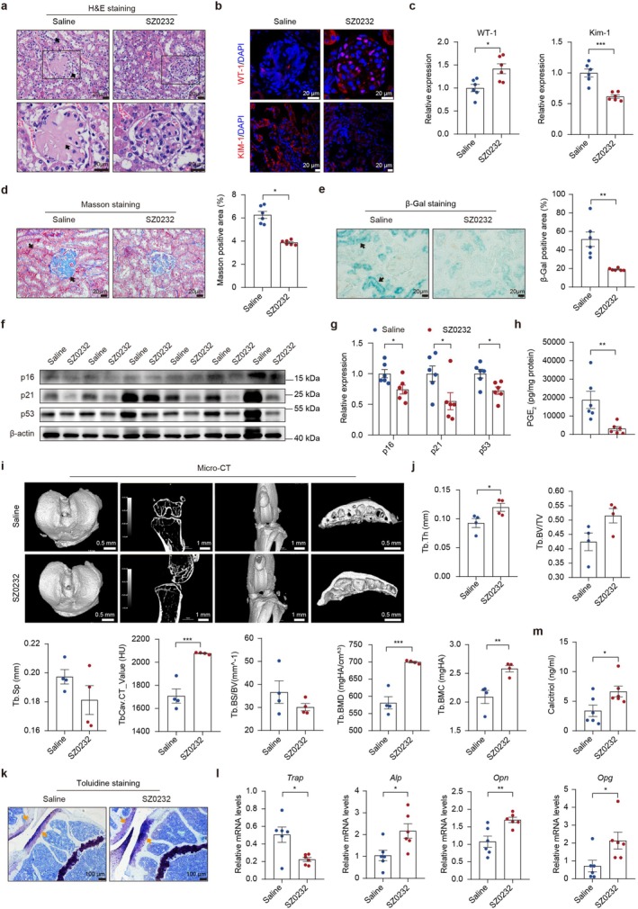 mPGES‐2 inhibitor SZ0232 alleviates aging‐related kidney dysfunction and promotes bone health. (a) Representative H&E staining of kidney tissues. (b) Representative images of WT‐1 and KIM‐1 by immunofluorescence. (c) Quantification of WT‐1 and KIM‐1. (d) Renal fibrosis analyzed by Masson's trichrome staining. (e) Renal aging analyzed by β‐Gal staining. (f) Representative blots of p16, p21, and p53 in the kidneys. (g) Quantification of p16, p21, and p53 in the kidney. (h) The content of PGE2in the kidney. (i) Bone microarchitecture by μCT. (j) Quantification of indices by μCT. (k) Bone structural and cellular features assessed by toluidine blue staining. (l) mRNA levels of biomarkers of osteoblasts and osteoclasts. (m) Calcitriol content in the kidneys. Data are presented as mean ± SEM. *p< 0.05, **p< 0.01, and ***p< 0.001; unpaired Student'st‐test was used for statistical analysis.