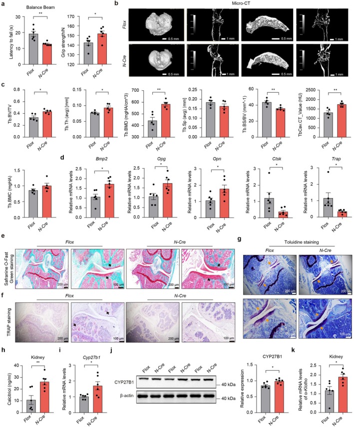 Effect of podocyte‐specificPtges2knockout on bone formation and health. (a) Effect of podocyte‐specificPtges2knockout on motor activity. (b) Bone microarchitecture by micro‐computed tomography (μCT). (c) Quantified indices by μCT. (d) Markers of osteogenesis and osteoclast resorption of podocytePtges2specific knockout mice. (e) Cartilage damage evaluated by Safranin O‐Fast Green Staining. (f) Osteoclastic bone resorption by tartrate‐resistant acid phosphatase (TRAP) staining. (g) Bone structural and cellular features assessment by toluidine blue staining of podocyte specificPtges2knockout mice. (h) Calcitriol content in the kidney. (i)Cyp27b1mRNA levels in the kidney. (j) Representative blots and quantification of CYP27B1 in the kidney. (k) The mRNA levels ofα‐klothoin the kidney. Data are presented as mean ± SEM. *p< 0.05, **p< 0.01, and ***p< 0.001; unpaired Student'st‐test was used for statistical analysis.