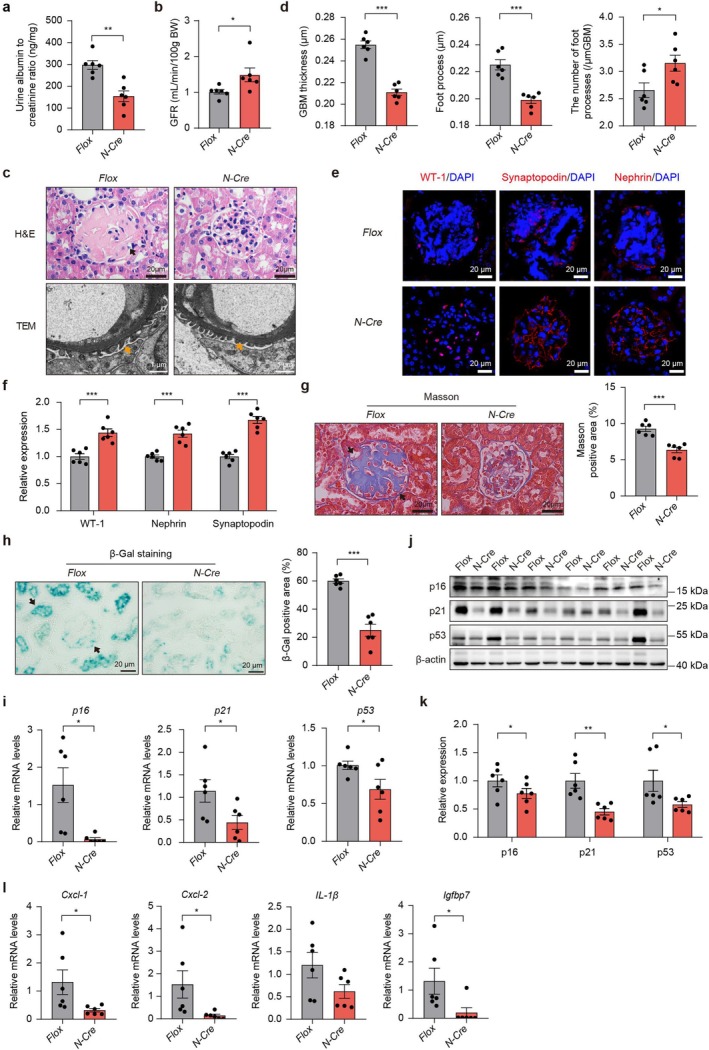 Podocyte‐specificPtges2deletion ameliorates kidney injury and renal aging. Podocyte‐specificPtges2knockout mice were aged naturally and sacrificed at 2 years of age for the following assays: (a) Urine albumin‐to‐creatinine ratio. (b) Glomerular filtration rate (GFR). (c) Assessment of morphological changes by H&E staining and TEM assay. (d) Quantification of GBM thickness, foot process length, and number of foot processes by TEM. (e) Podocyte markers in the glomeruli. (f) Quantification of podocyte markers. (g) Renal fibrosis analyzed by Masson's trichrome staining. (h) Renal aging evaluated by β‐Gal staining. (i) mRNA levels ofp16,p21, andp53. (j) Representative blots of aging biomarkers. (k) Quantification of aging biomarkers. (l) Senescence‐associated secretory phenotype (SASP) factors levels.N‐Cre:Ptges2f/f;Nphs2‐Cre.Flox:Ptges2f/f. Data are presented as mean ± SEM. *p< 0.05, **p< 0.01, and ***p< 0.001; unpaired Student'st‐test was used for statistical analysis.