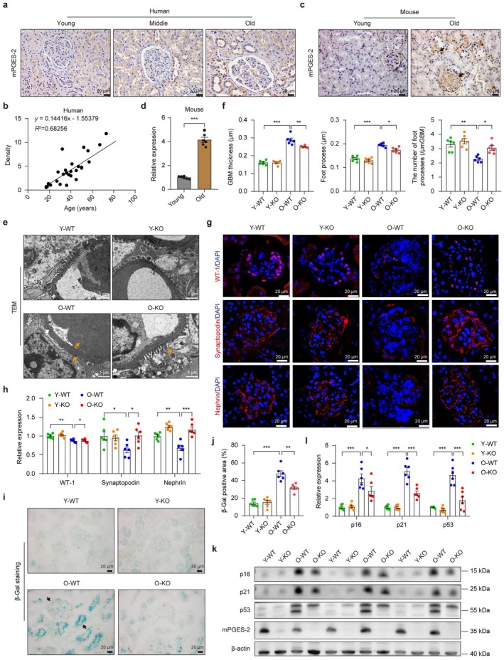 Ptges2knockout mitigates renal aging and related kidney dysfunction. (a) Representative images of mPGES‐2 expression in human kidneys, scale bars = 20 μm. (b) Correlation analysis of mPGES‐2 protein expression with age in human kidneys. (c) Expression of mPGES‐2 in young and old mouse kidneys, scale bars = 20 μm. (d) Quantification of mPGES‐2 expression in mouse kidneys. (e) Representative images of transmission electron microscopy (TEM). (f) Measurement of glomerular basement membrane (GBM) thickness, foot process length, and number of foot processes by TEM. (g) Immunofluorescence (IF) staining of WT‐1, synaptopodin and nephrin, podocyte markers. (h) Quantification of podocyte markers. (i) Representative images of β‐Gal staining. (j) Quantification of positive β‐Gal staining. (k) Representative blots of p16, p21, p53, key aging biomarkers. (l) Quantification of aging biomarkers. Data are presented as mean ± SEM. *p< 0.05, **p< 0.01, and ***p< 0.001; unpaired Student'st‐test was used for (d) and one‐way ANOVA with Tukey's test for f, h, j, and l.
