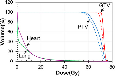 DVHs for Case 1 comparing the plans calculated with the NCT (solid lines) and the RT (dashed lines).