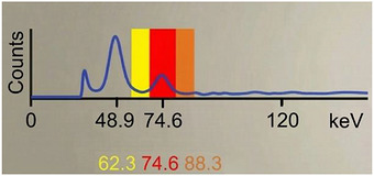 Tb‐161 spectrum with energy windows (Protocol EW1).