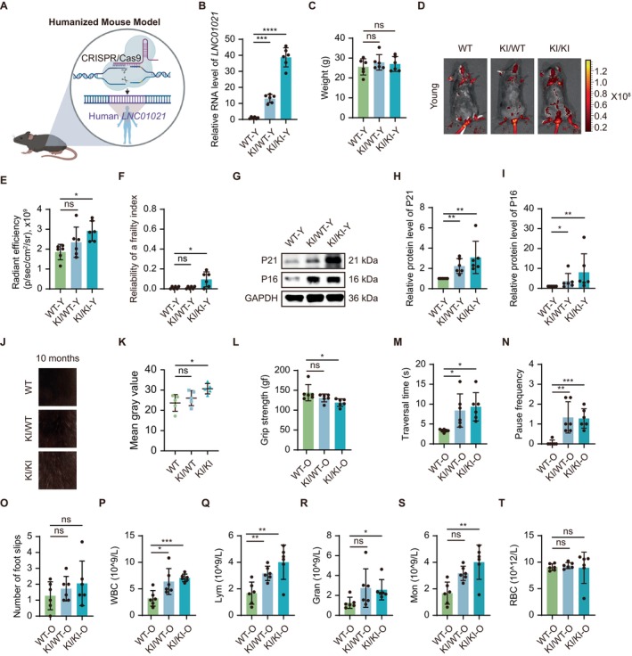LINC01021overexpression promotes aging‐like phenotypes in humanized transgenic mice. (A) Schematic of the humanizedLINC01021‐KI mouse model. (B) qRT‐PCR analysis of humanLINC01021expression in spleen from young WT, KI/WT, and KI/KI mice. (C) Body weight of young mice. (D, E) Representative NIR fluorescence imaging using a SA‐β‐Gal responsive probe and quantification of senescence‐associated signal intensity in young mice. (F) Frailty index in young mice. (G‐I) Western blot analysis and quantification of P21 and P16 protein levels in spleen from young mice. (J, K) Representative images and quantification of fur depigmentation in 10‐month‐old male mice. (L) Forelimb grip strength in aged mice. (M‐O) Balance and coordination performance in aged mice assessed by balance beam traversal time (M), pause frequency (N), and foot slips (O). (P–T) Hematological parameters in aged mice, including white blood cells (WBC), lymphocytes, granulocytes, monocytes, and red blood cells (RBC).