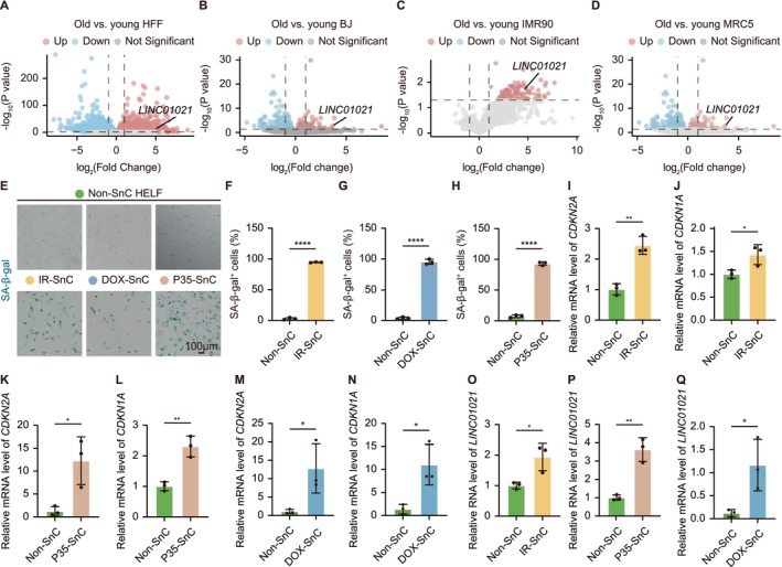 LINC01021is robustly upregulated across multiple senescence models in human fibroblasts. (A‐D) Volcano plots showing transcriptional changes between young and senescent fibroblasts in four independent human fibroblast strains (HFF, BJ, IMR90, and MRC5), highlighting consistent upregulation ofLINC01021. (E) Representative SA‐β‐Gal staining images of HELF cells subjected to IR‐induced, DOX‐induced, or replicative senescence. (F‐H) Quantification of SA‐β‐Gal+cells corresponding to the conditions shown in (E). (I‐N) qRT‐PCR analysis of senescence markersCDKN2AandCDKN1Ain HELF cells under IR‐induced (I and J), replicative (K and L), or DOX‐induced (M and N) senescence. (O‐Q) qRT‐PCR analysis showing induction ofLINC01021expression in HELF cells across the indicated senescence models. Data are shown as mean ± SEM from at least three independent experiments.
